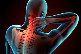 Cervical osteocondrosis