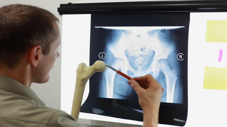 The doctor performs an X-ray examination for hip arthrosis